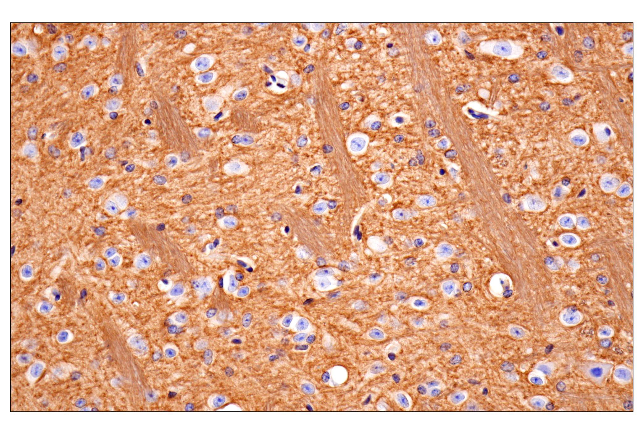  Image 28: Mouse Reactive Exosome Marker Antibody Sampler Kit