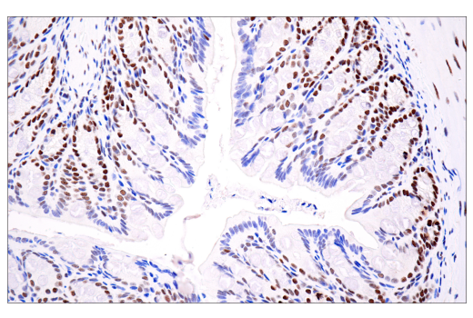 Immunohistochemistry Image 1: ATRX (E5X7O) Rabbit mAb