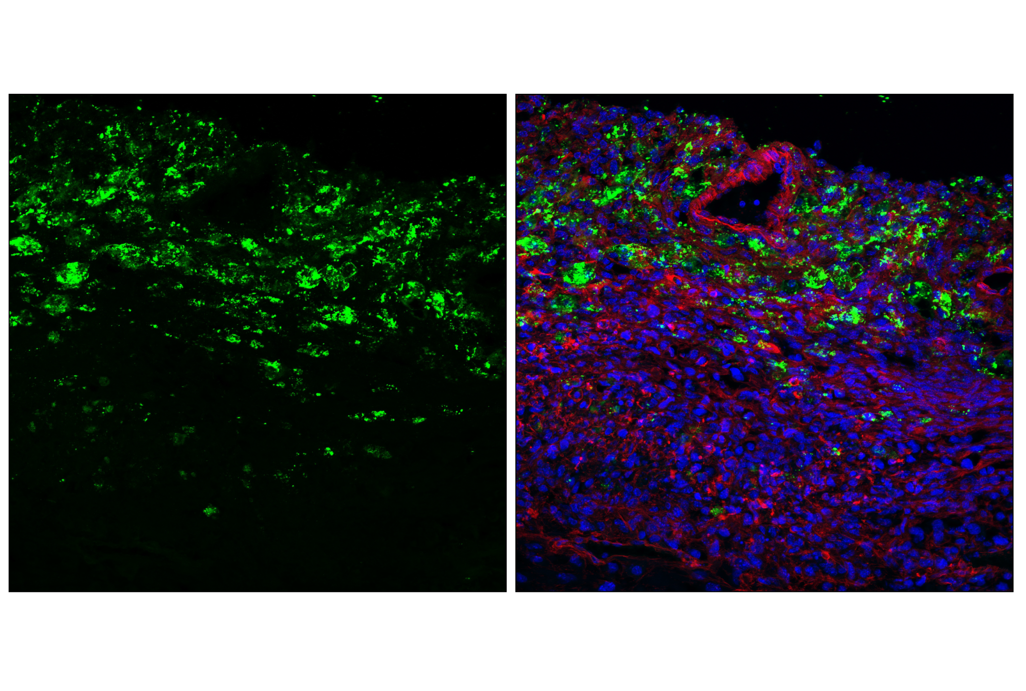 Immunofluorescence Image 1: Granzyme C (E5M3N) Rabbit mAb (BSA and Azide Free)