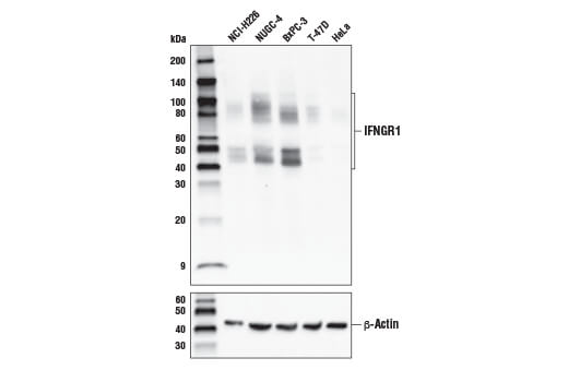 Western Blotting Image 1: IFNGR1 (E444) Antibody
