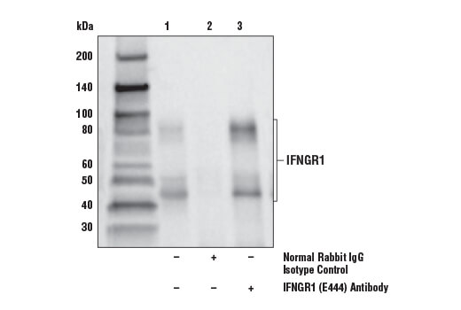 Immunoprecipitation Image 1: IFNGR1 (E444) Antibody