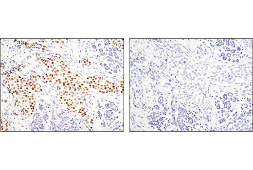 Immunohistochemistry Image 1: GATA-3 (D13C9) XP® Rabbit mAb (BSA and Azide Free)