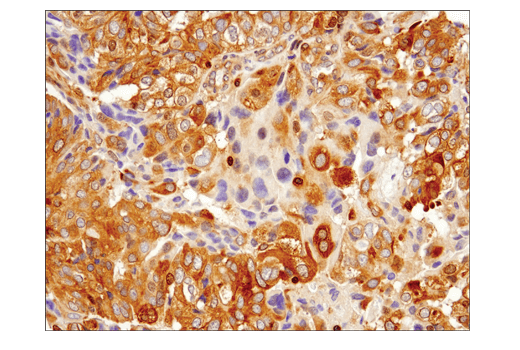 Immunohistochemistry Image 3: IRF-3 (D9J5Q) Mouse mAb