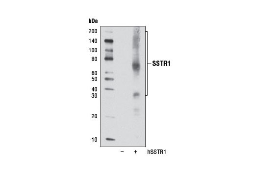 Western Blotting Image 1: SSTR1 Antibody