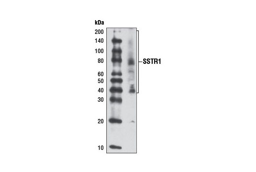 Western Blotting Image 2: SSTR1 Antibody