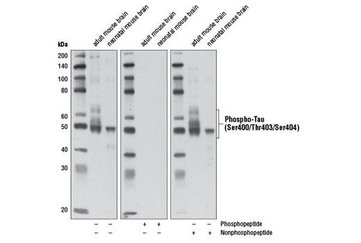 Western Blotting Image 1: Phospho-Tau (Ser400/Thr403/Ser404) Antibody