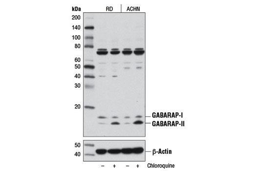Western Blotting Image 1: GABARAP Antibody