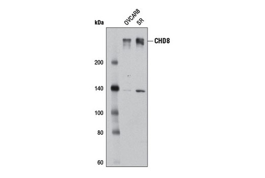  Image 1: Chromodomain Helicase DNA-Binding (CHD) Family Antibody Sampler Kit