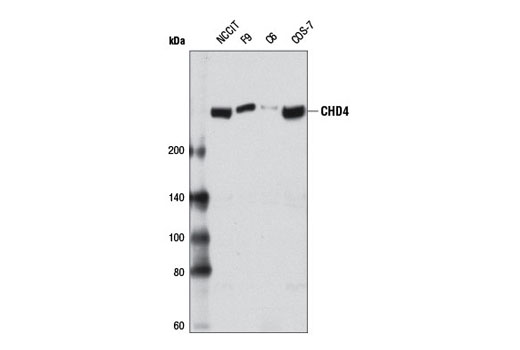  Image 1: NuRD Complex Antibody Sampler Kit