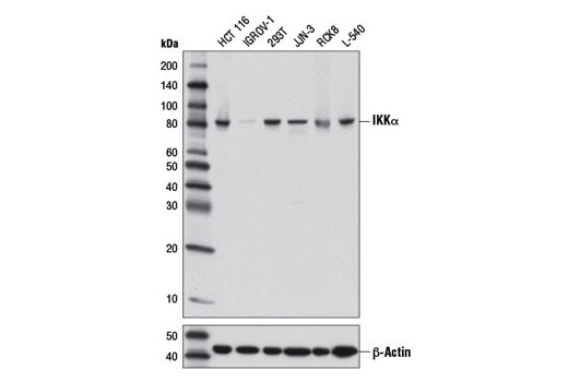  Image 1: NF-κB Non-Canonical Pathway Antibody Sampler Kit
