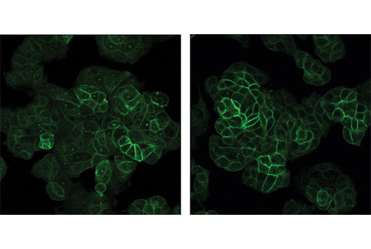 Immunofluorescence Image 2: Image-iT® FX Signal Enhancer