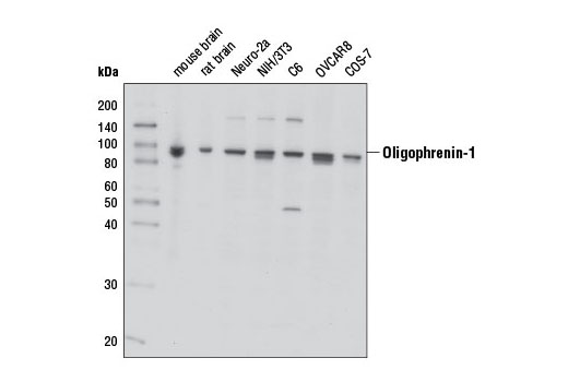 Western Blotting Image 1: Oligophrenin-1 Antibody