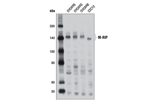 Western Blotting Image 1: M-RIP Antibody
