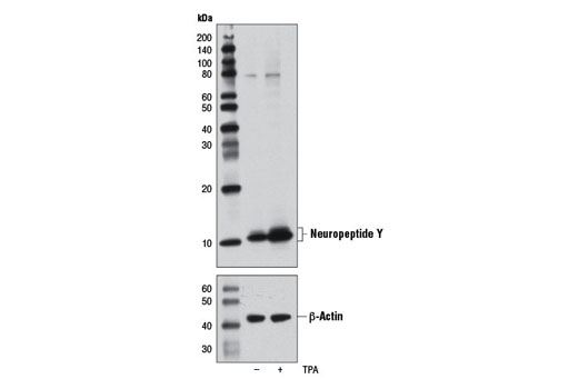 Western Blotting Image 1: Neuropeptide Y (D7Y5A) XP® Rabbit mAb