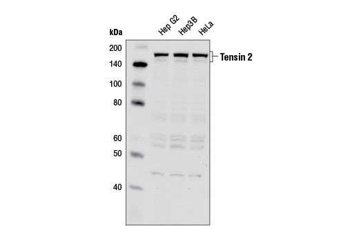 Western Blotting Image 1: Tensin 2 Antibody