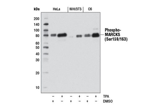 Western Blotting Image 1: Phospho-MARCKS (Ser159/163) (D13D2) Rabbit mAb