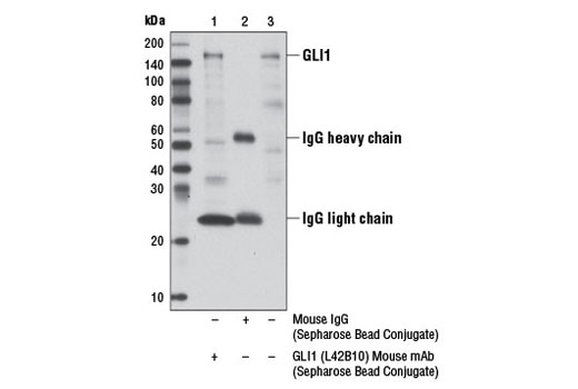 Immunoprecipitation Image 1: GLI1 (L42B10) Mouse mAb (Sepharose® Bead Conjugate)