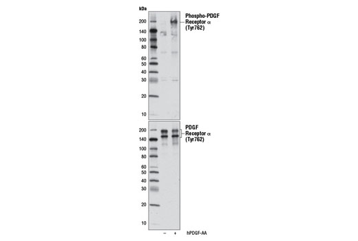 Western Blotting Image 1: Phospho-PDGF Receptor α (Tyr762) Antibody