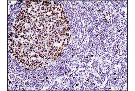 Immunohistochemistry Image 2: MCM2 (1E7) Mouse mAb