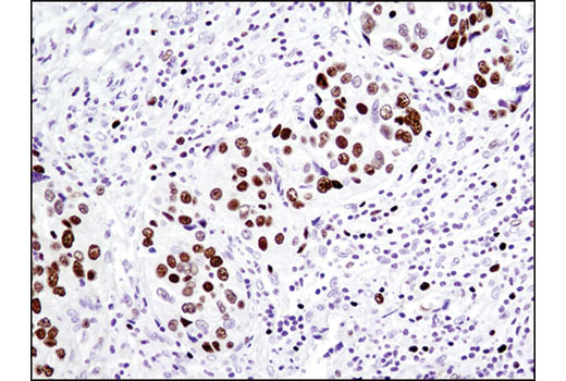 Immunohistochemistry Image 3: MCM2 (1E7) Mouse mAb
