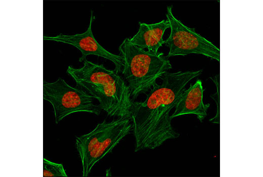 Immunofluorescence Image 1: Pan-Methyl-Histone H3 (Lys9) (D54) XP® Rabbit mAb (Alexa Fluor® 647 Conjugate)