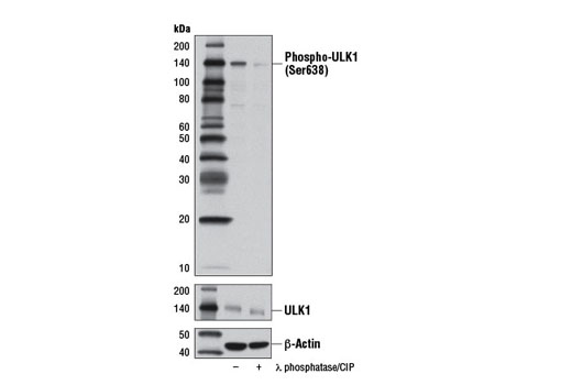 Western Blotting Image 2: Phospho-ULK1 (Ser638) Antibody