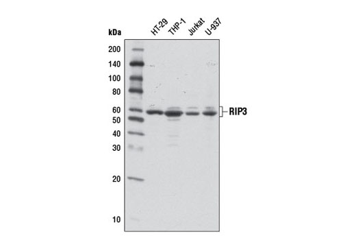 Western Blotting Image 1: RIP3 Antibody