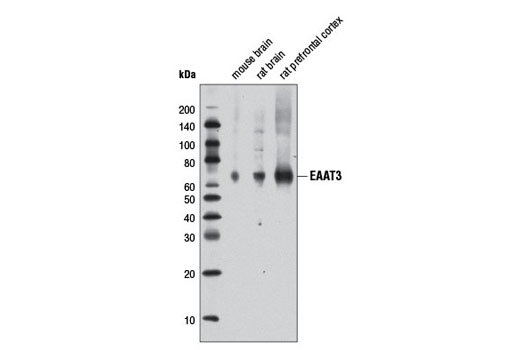 Western Blotting Image 1: EAAT3 Antibody