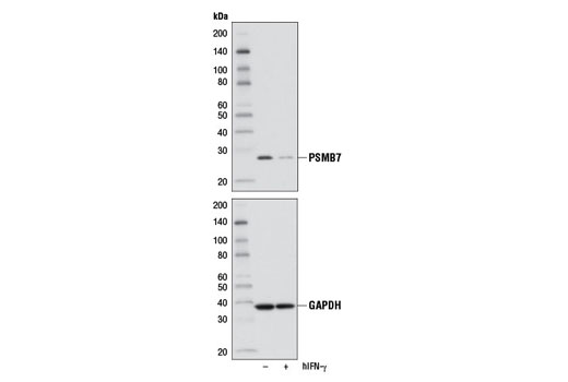 Western Blotting Image 2: PSMB7 Antibody