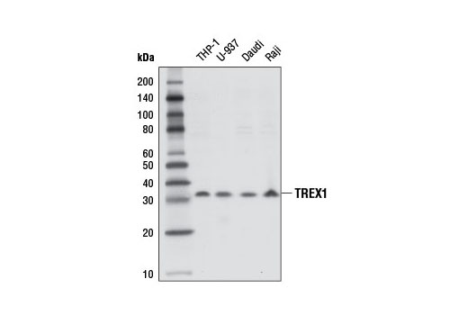 Western Blotting Image 1: TREX1 Antibody