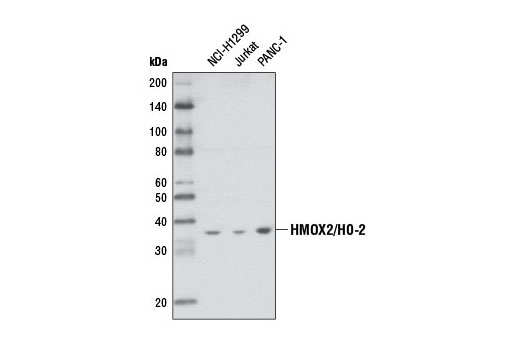 Western Blotting Image 1: HMOX2/HO-2 Antibody