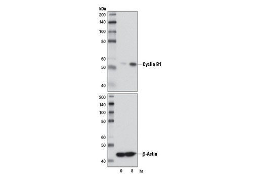  Image 13: Cell Cycle Regulation Antibody Sampler Kit II