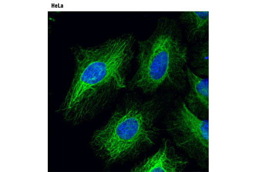 Immunofluorescence Image 1: Plectin-1 (D6A11) Rabbit mAb