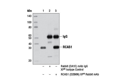 Immunoprecipitation Image 1: RCAS1 (D2B6N) XP® Rabbit mAb