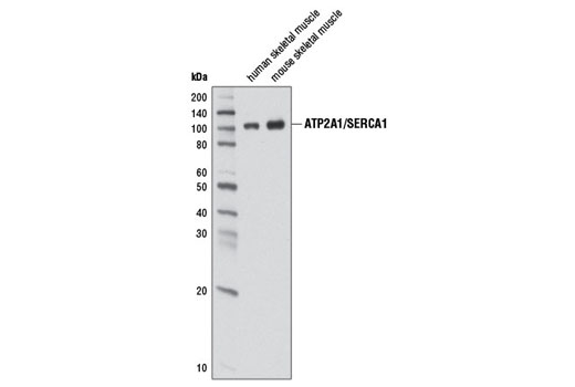  Image 1: Calcium Ion Regulation Antibody Sampler Kit