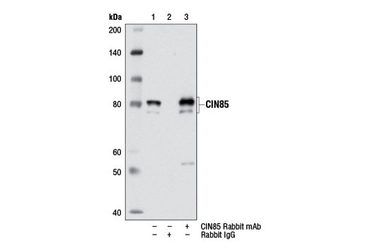 Immunoprecipitation Image 1: CIN85 (D1A4) Rabbit mAb
