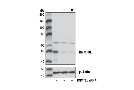  Image 1: SignalSilence® DNMT3L siRNA I (Mouse Specific)