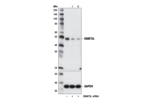  Image 2: SignalSilence® DNMT3L siRNA I (Mouse Specific)