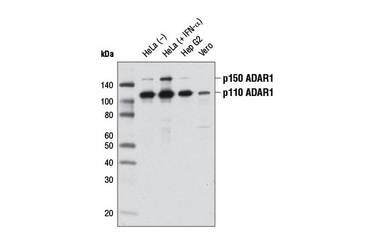 Western Blotting Image 1: ADAR1 Antibody