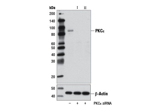  Image 1: SignalSilence® PKCε siRNA II