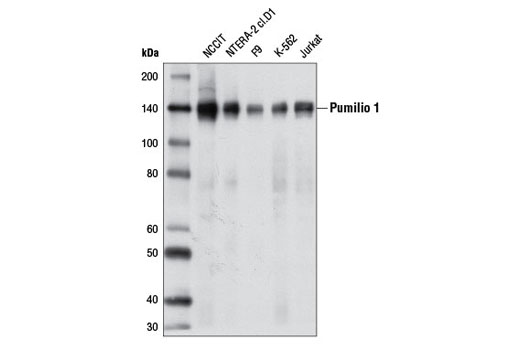 Western Blotting Image 1: Pumilio 1 Antibody