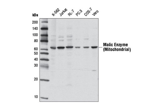 Western Blotting Image 1: Malic Enzyme 2 Antibody