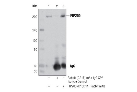Immunoprecipitation Image 1: FIP200 (D10D11) Rabbit mAb
