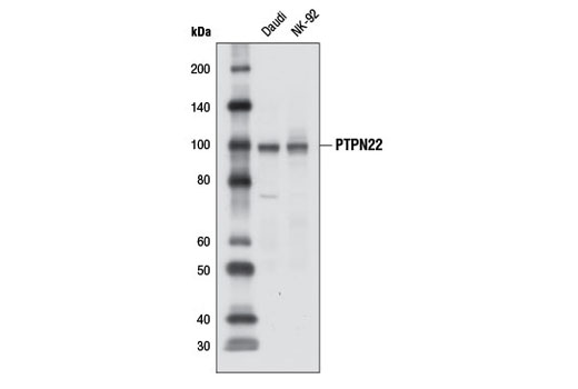 Western Blotting Image 1: PTPN22 Antibody