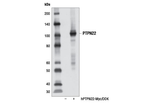 Western Blotting Image 2: PTPN22 Antibody