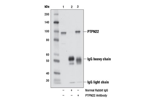 Immunoprecipitation Image 1: PTPN22 Antibody