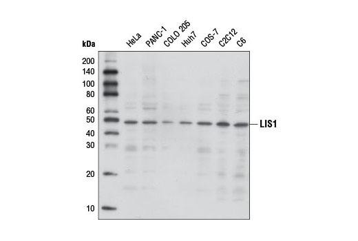 Western Blotting Image 1: LIS1 Antibody