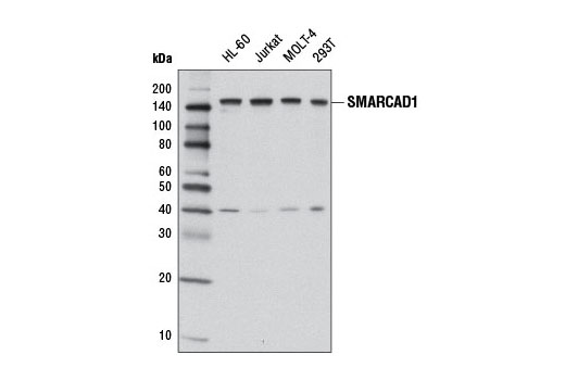 Western Blotting Image 1: SMARCAD1 Antibody