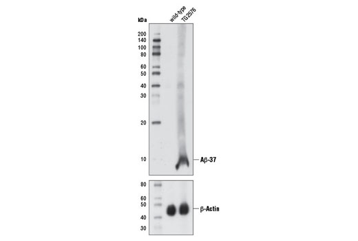  Image 8: β-Amyloid Peptides Antibody Sampler Kit