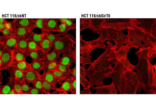 Immunofluorescence Image 1: SirT6 (D8D12) Rabbit mAb